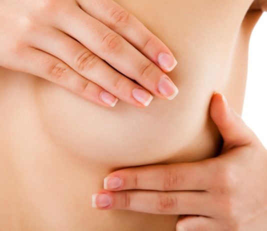 ¿Qué signos pueden advertir un posible cáncer de mama?
