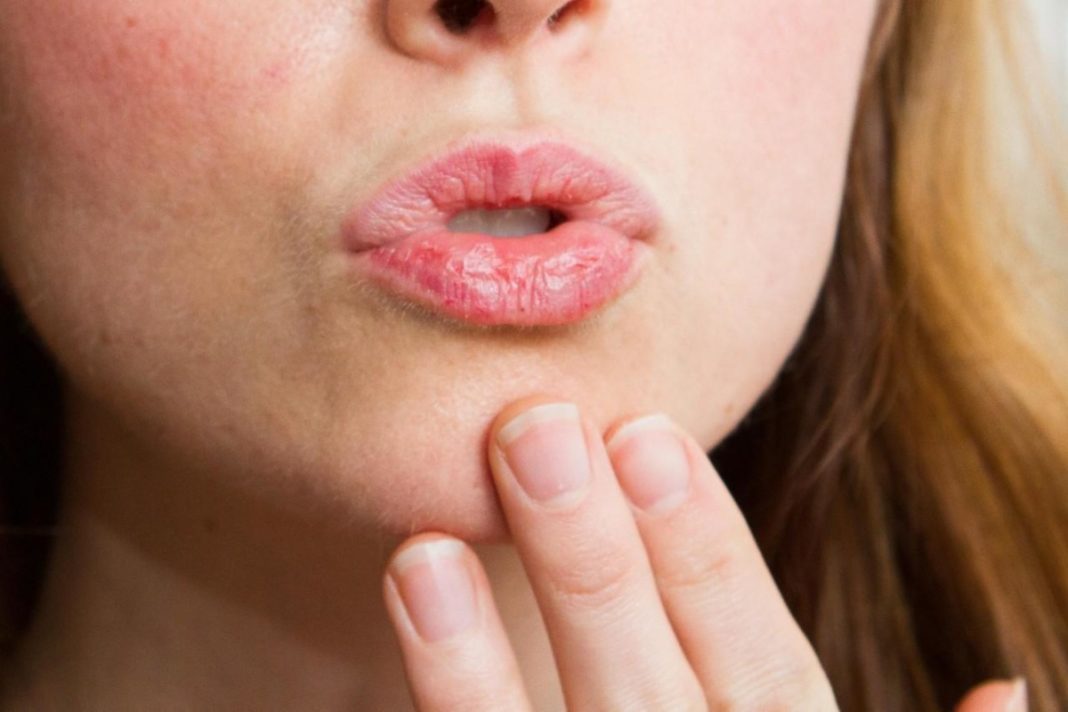 Los labios agrietados son causados por diferentes razones, sigue leyendo y descubre cómo mantenerlos saludables y cómo evitar resecarlos.