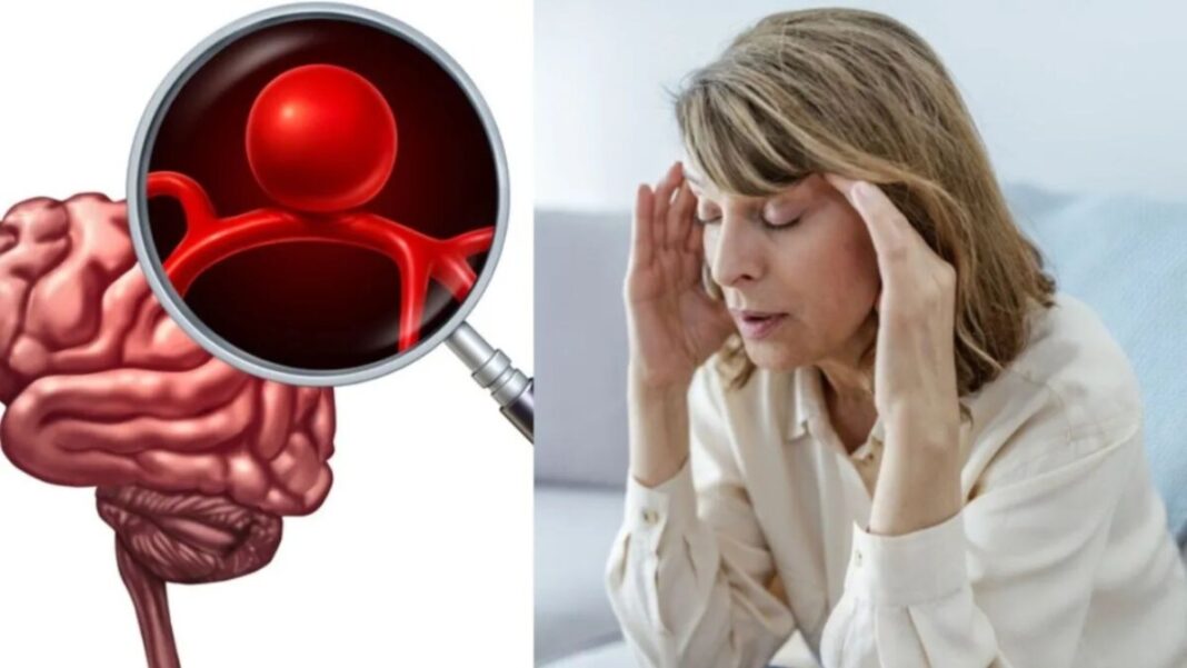 Síntomas de un aneurisma que confundes con un dolor de cabeza