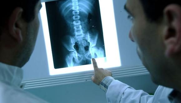 Conoce la diferencia entre una placa de rayos X y tomografía para evaluar el pulmón