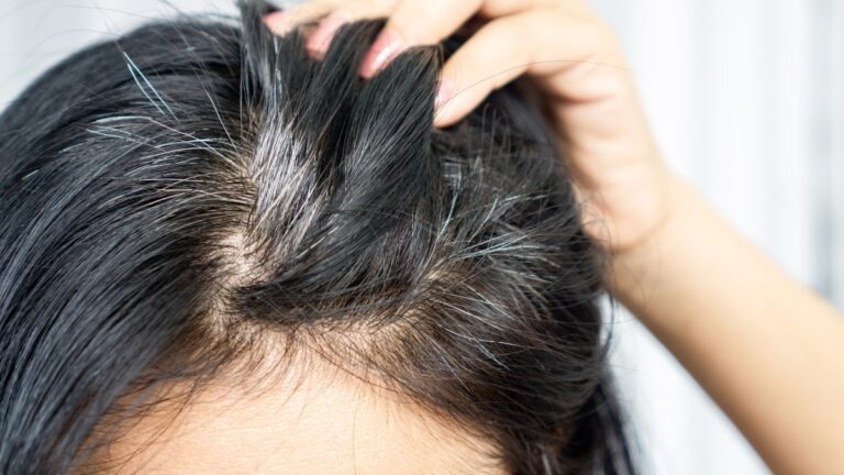 Consejos para lidiar con las primeras canas