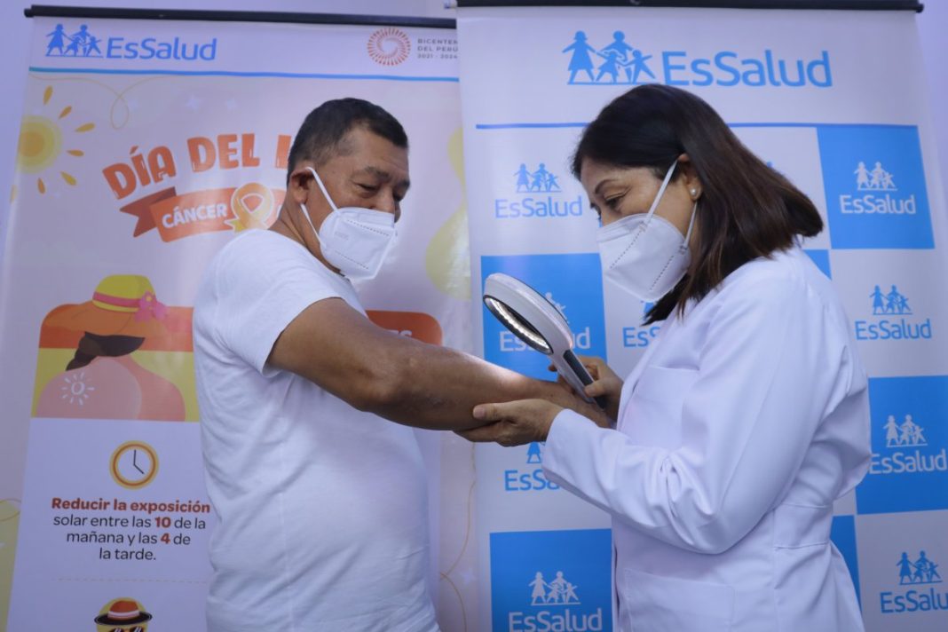 EsSalud atendió 135 personas en campaña de prevención contra el cáncer de piel.