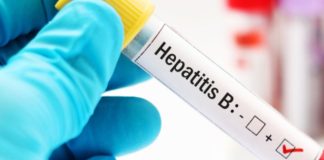 Hepatitis B: conoce aquí los síntomas y cómo prevenir el contagio
