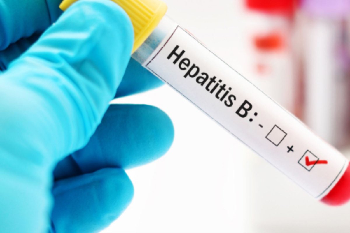 Hepatitis B: conoce aquí los síntomas y cómo prevenir el contagio