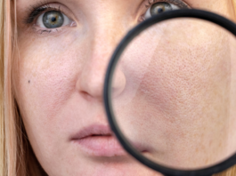 ¿Cómo reducir los poros abiertos de la cara? Sigue estos consejos