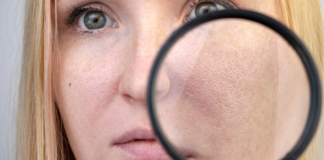 ¿Cómo reducir los poros abiertos de la cara? Sigue estos consejos