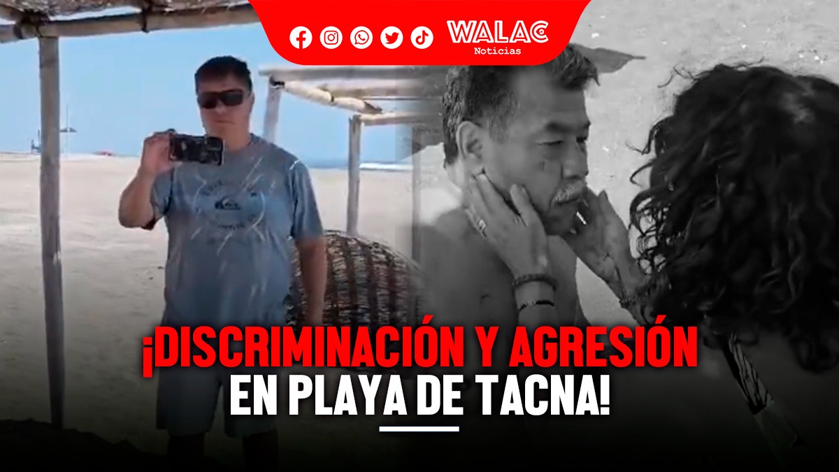 ¡Discriminación y agresión en playa de Tacna! Víctima sufre rotura de mandíbula