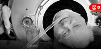 Falleció 'Polio' Paul, el hombre que vivió 70 años en un pulmón de acero