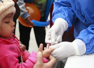 El 39% de niños en Piura presenta anemia