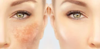 Elimina arrugas y manchas de tu rostro