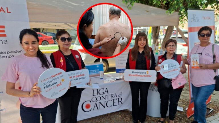 Piura realizan campaña gratuita de prevención del cáncer de piel hasta este viernes 17