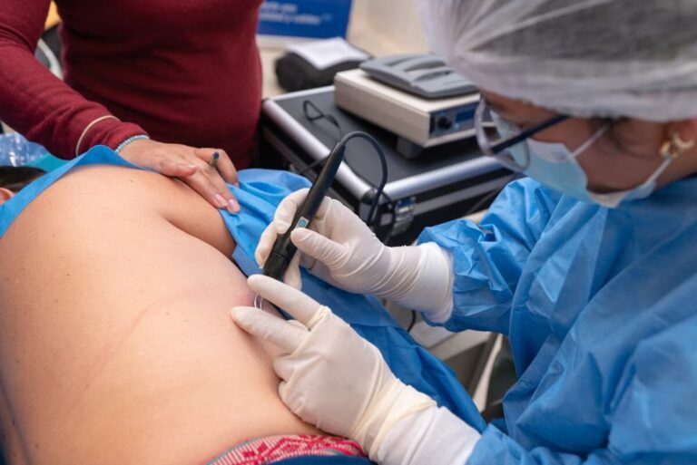 Diresa descarta alerta epidemiológica de lepra y asegura que no es altamente contagiosa