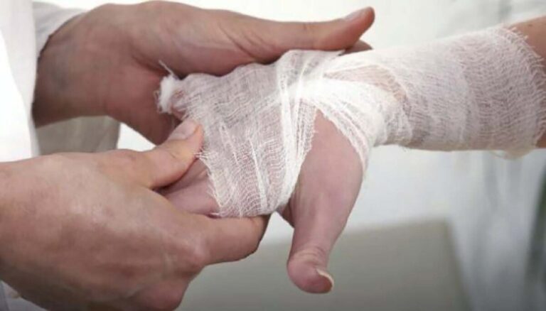 Diresa Piura confirma caso de lepra y asegura seguimiento médico