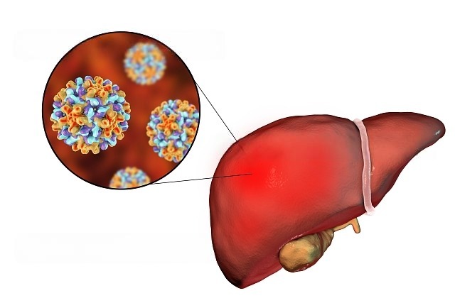 Hepatitis B: lo que debes saber para prevenirla y detectarla a tiempo