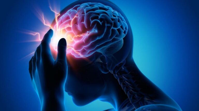¿Qué es un infarto cerebral y cómo detectarlo a tiempo?