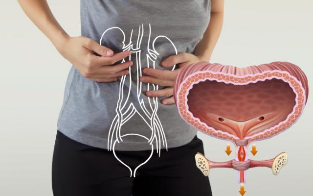 Incontinencia urinaria de esfuerzo: causas, síntomas y tratamientos efectivos