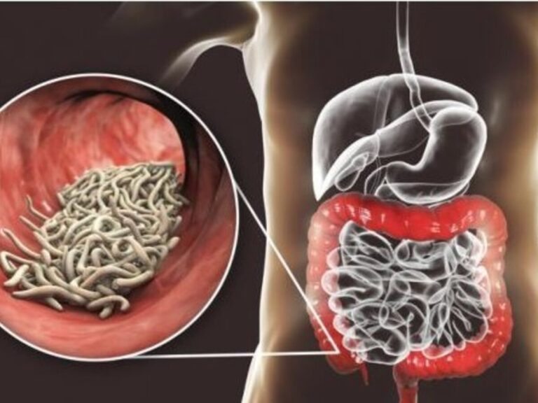 Parásitos intestinales: señales de alerta y prevención en casa