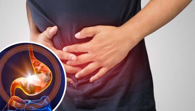 Gastritis: conoce el diagnóstico y tratamiento