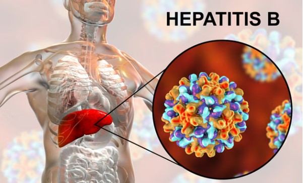 ¿Qué es la hepatitis B y cómo prevenirla en adultos?