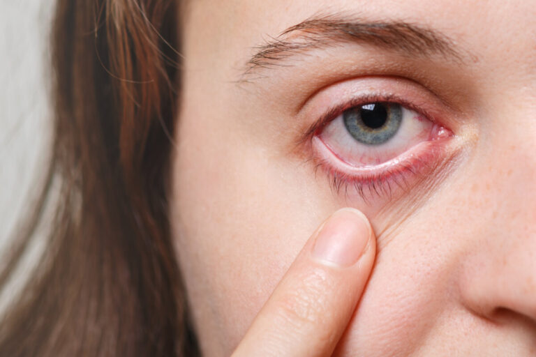 Cuidado de los ojos en verano: prevención y consejos oftalmológicos