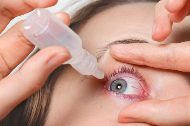 Glaucoma: causas, síntomas y cómo detectarlo a tiempo
