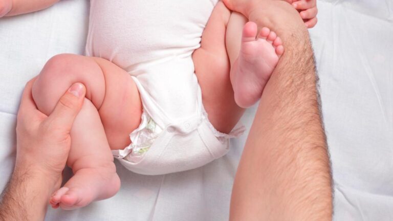Displasia de cadera en niños: diagnóstico y prevención temprana en Perú