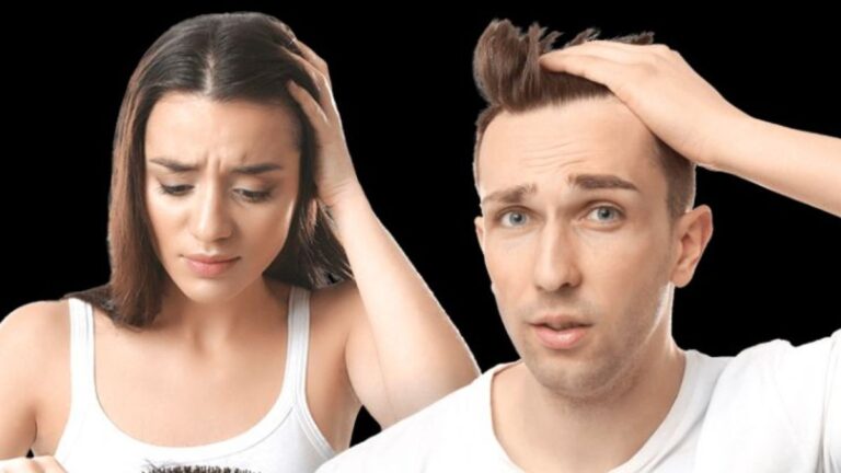 Caída del cabello en hombres y mujeres: ¿Qué cuidados se debe tener?