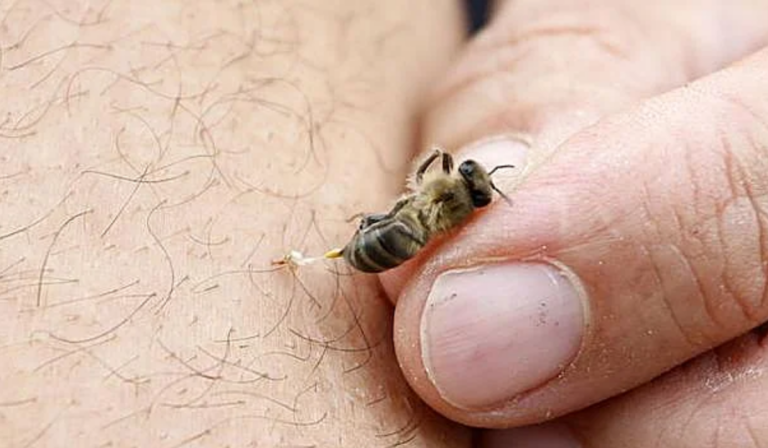 Los propios vecinos quienes acudieron en su auxilio utilizando extintores, agua e incluso quemando llantas y ramas secas.