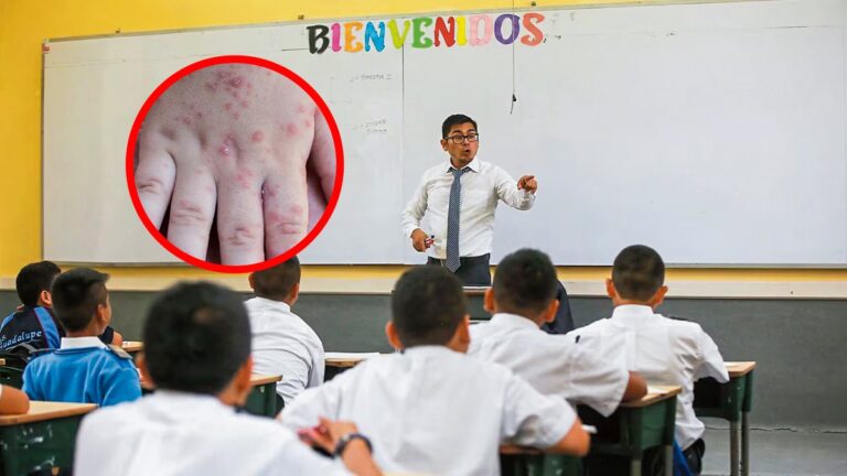 UGEL Piura confirma brote del virus Coxsackie en colegios de la región UGEL Piura confirma brote del virus Coxsackie en colegios de la región