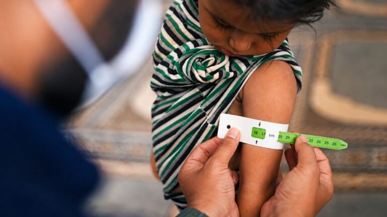 Desnutrición crónica infantil afecta al 15% de los niños menores de cinco años en Piura Desnutrición crónica infantil afecta al 15% de los niños menores de cinco años en Piura